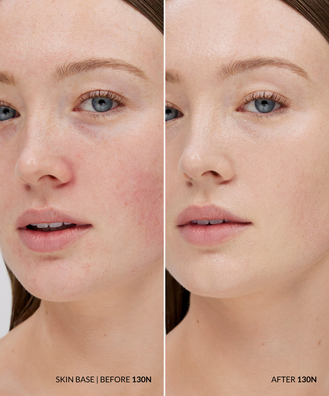 The Skin Base Collection